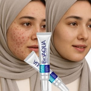 کرم ضد جوش و جای جوش بیوآکوا حاوی سالیسیلیک اسید